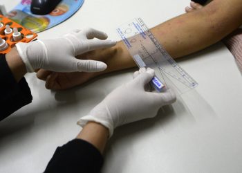 Policlínica de Taguatinga amplia acesso a exame que identifica causas de alergias