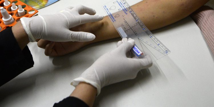 Policlínica de Taguatinga amplia acesso a exame que identifica causas de alergias